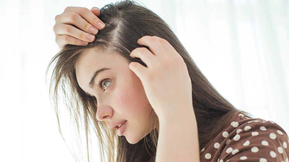 Natural Remedies for Hair Loss, Dandruff and Hair Problems